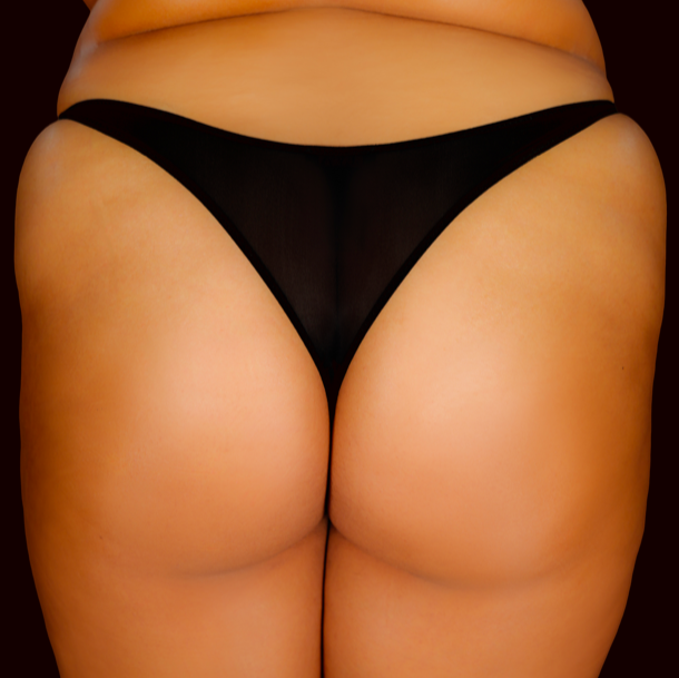 Striplink - BB THONG